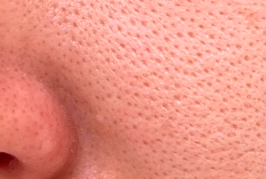 Open Pores